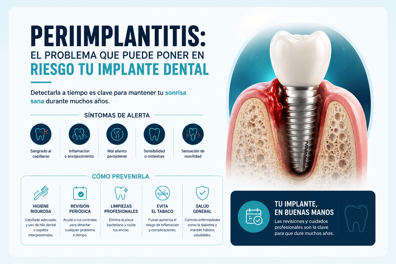 Periimplantitis